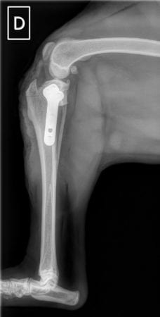 traitement-de-la-rupture-du-ligament-croise